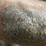 De ce au devenit coatele aspre și cum este legată aceasta de starea internă a corpului? de-ce-au-devenit-coatele-aspre-si-cum-este-legata.webp.webp